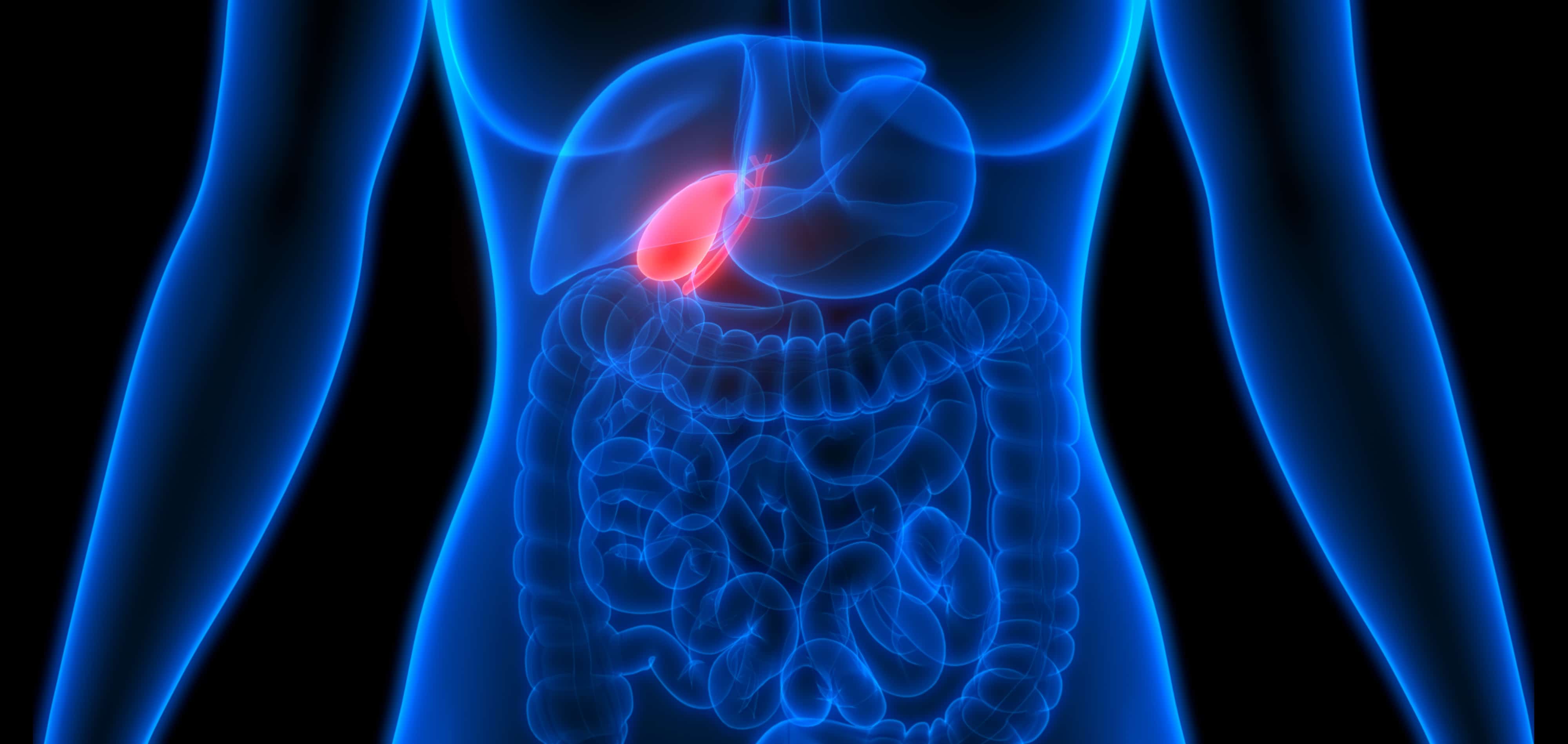 Saiba tudo sobre a cirurgia de pedra na vesícula - Portal